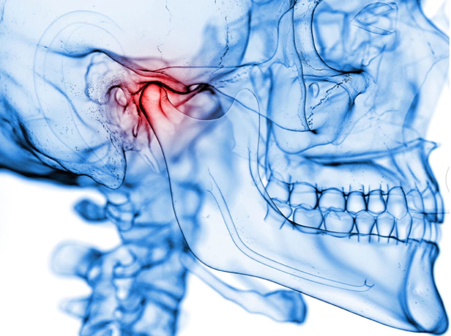 Disfunció temporomandibular