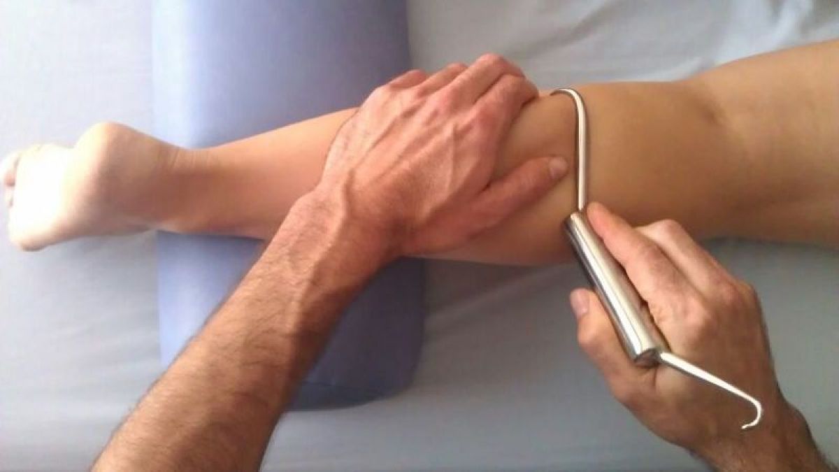 Fibròlisi diacutània (Ganxos)